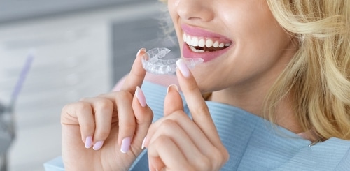 Teeth Whitening in Dunn, NC | J. Michael Williams, DDS
