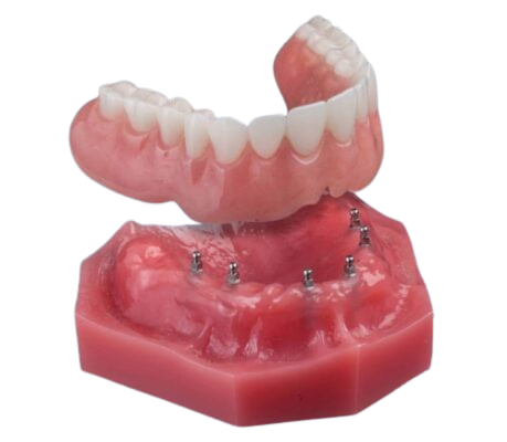 Snap-On Dentures in Dunn, NC | Book a Free Implant Consultation