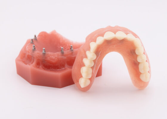 Mini Dentures in Dunn, NC | Book Your Free Implant Consultation!