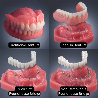 Dental Plate Options in Dunn, NC | Affordable Dentures Options