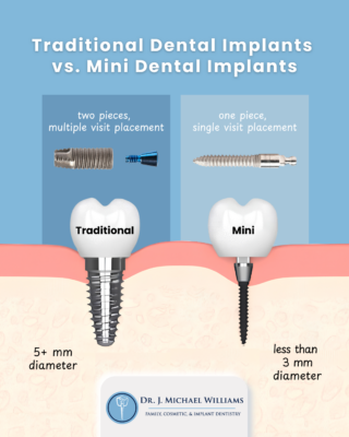 Dental Implants in Fuquay-Varina, NC | Free Implant Consultations